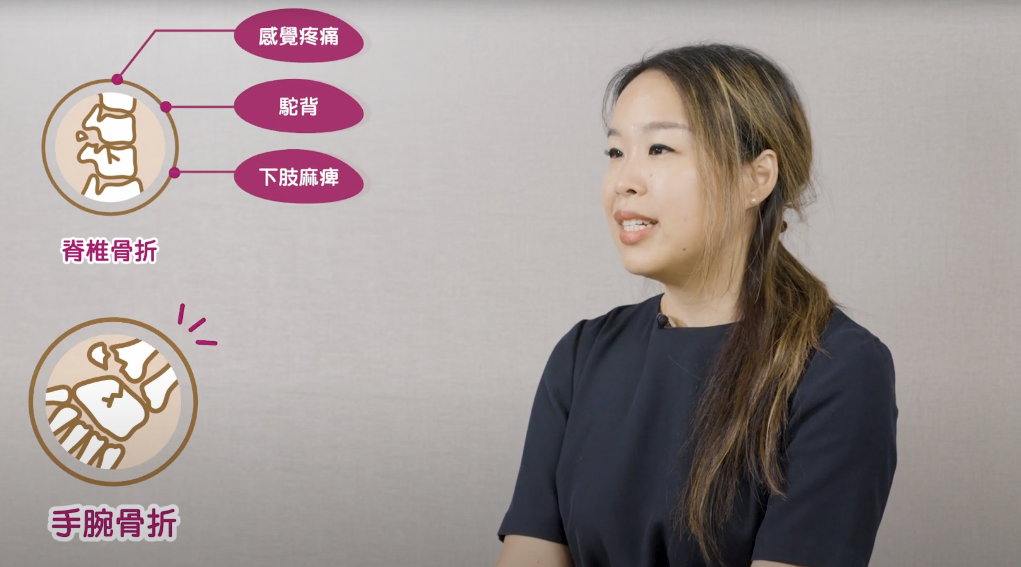 骨質疏鬆系列:趨「骨」避兇第二集: 骨質疏鬆不鳴則已,一鳴就驚人?講解醫生 - 趙嘉俊醫生,毛鈺婷醫生